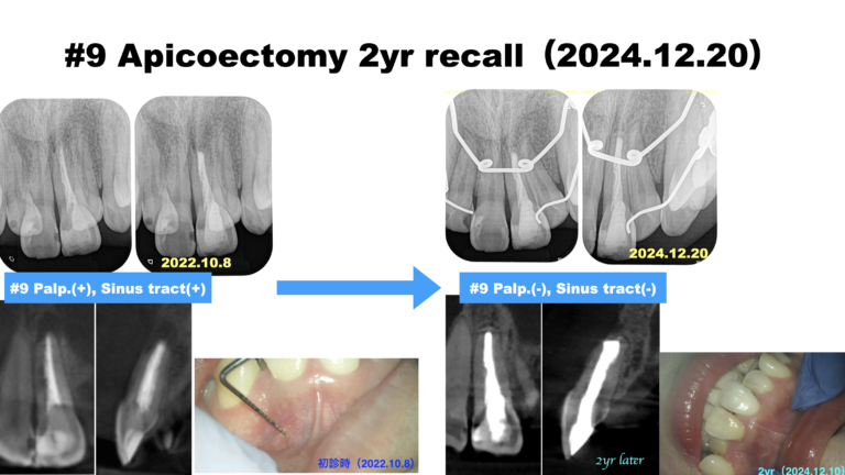 eac66390f1024f0e8693858116f79854